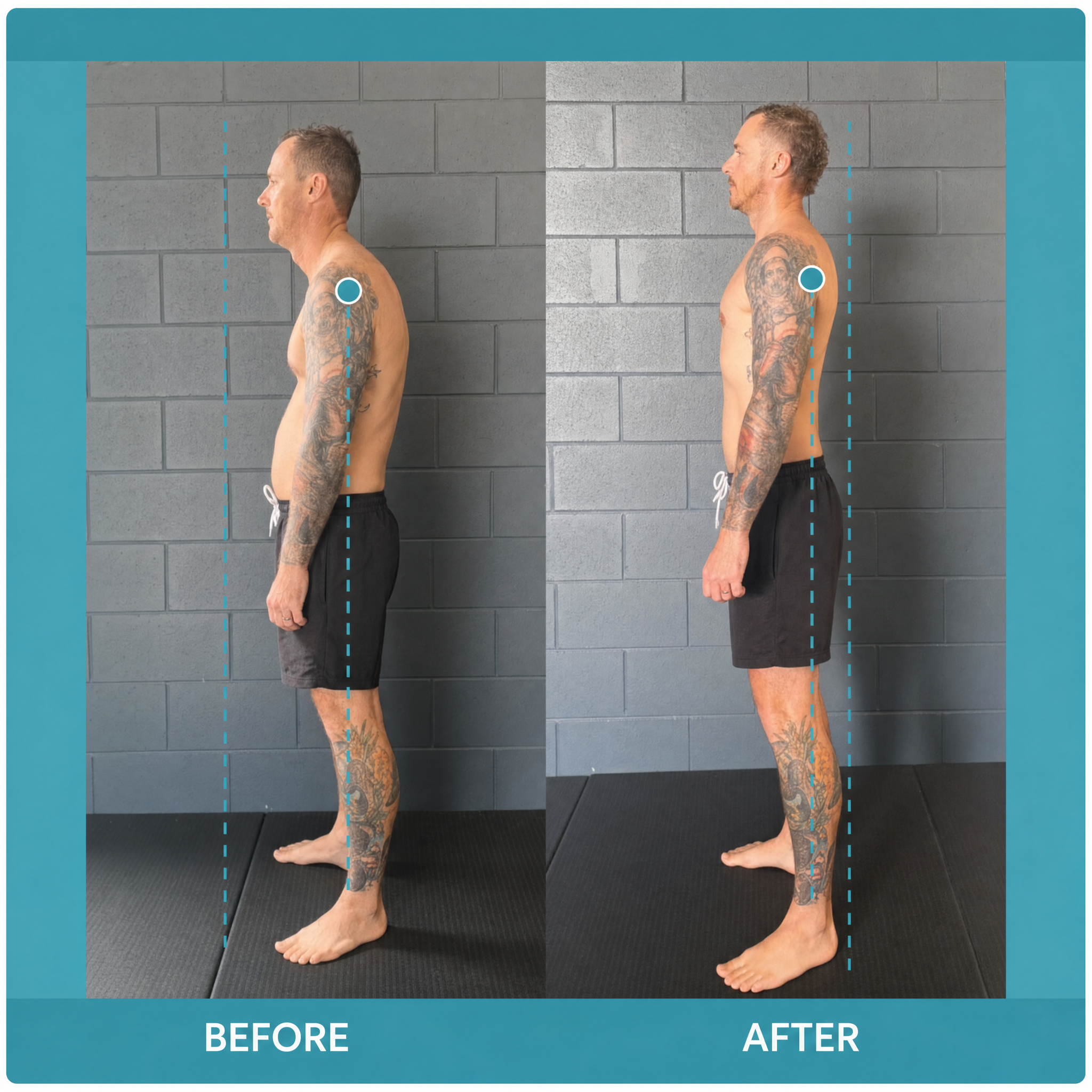 Instant Posture Corrector