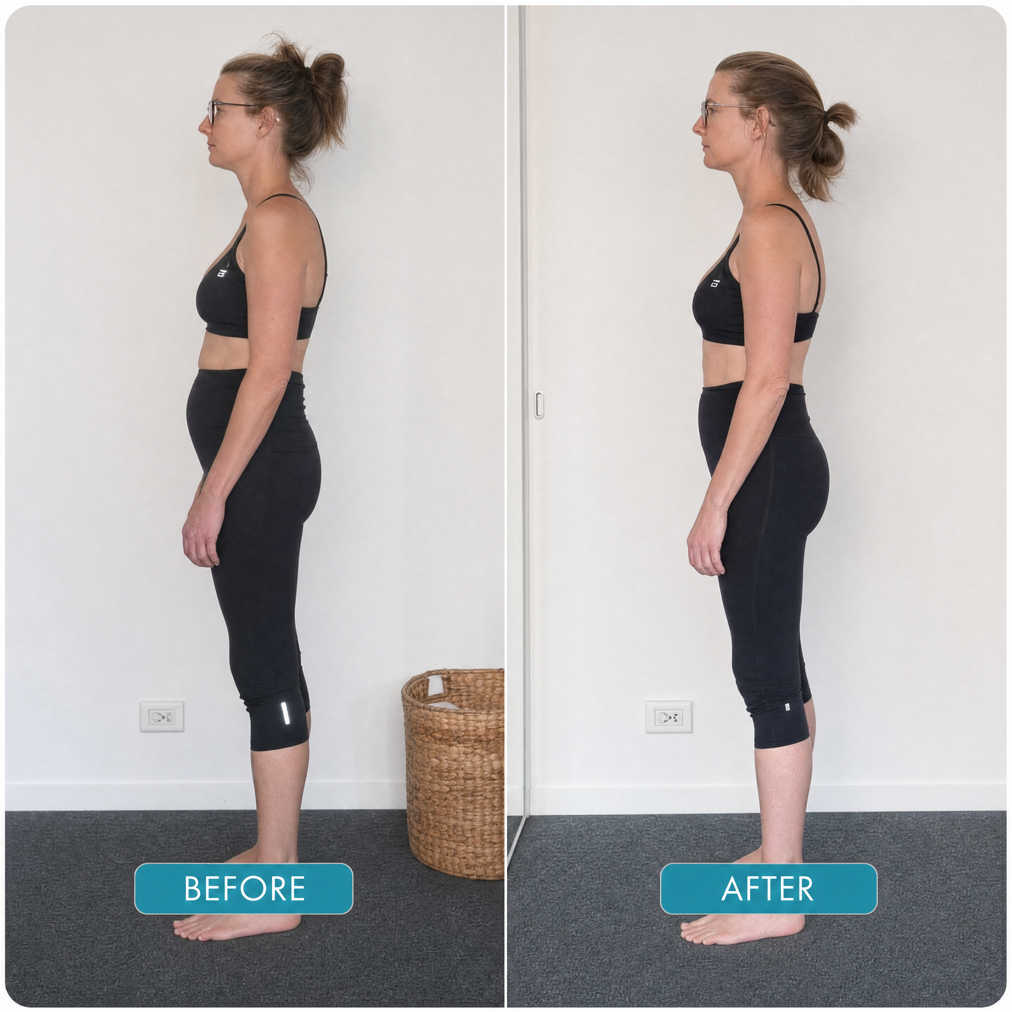 Instant Posture Corrector