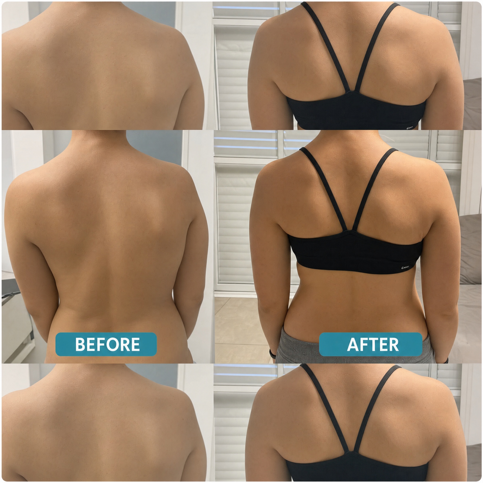 Instant Posture Corrector